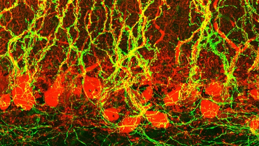 Photo of Neurobiological scan 