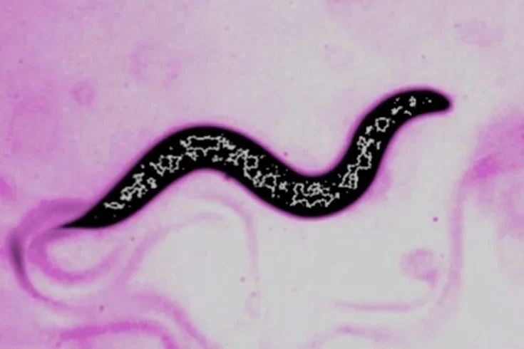 Genetic variation and disease