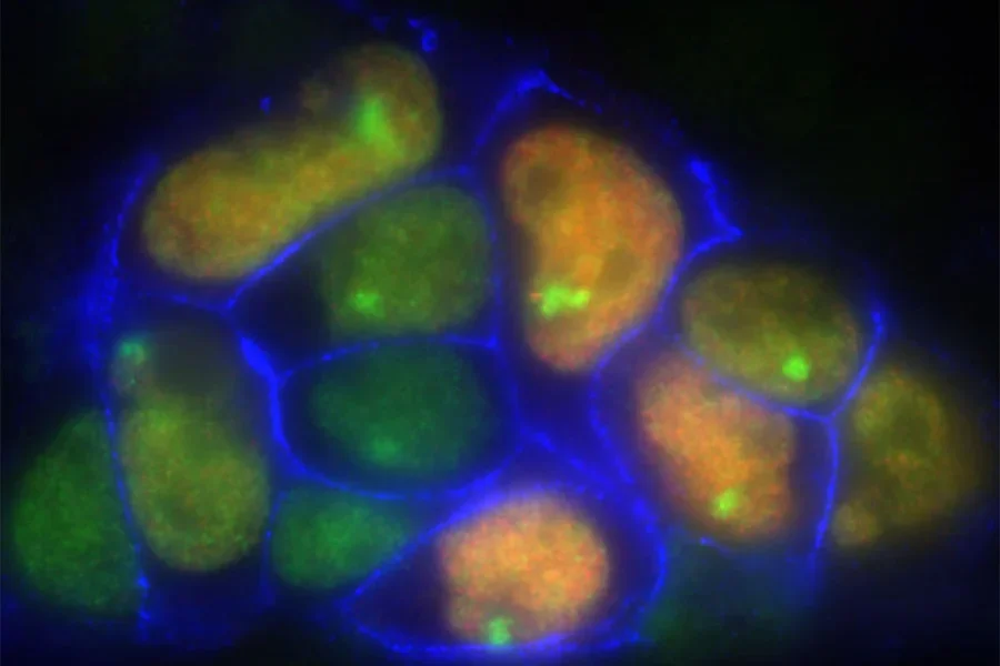 Epigenetics, Gene Regulation and Genome Dynamics